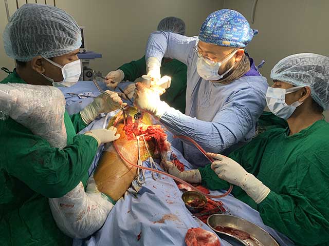 Ankle Sprain With Pott’s Fracture