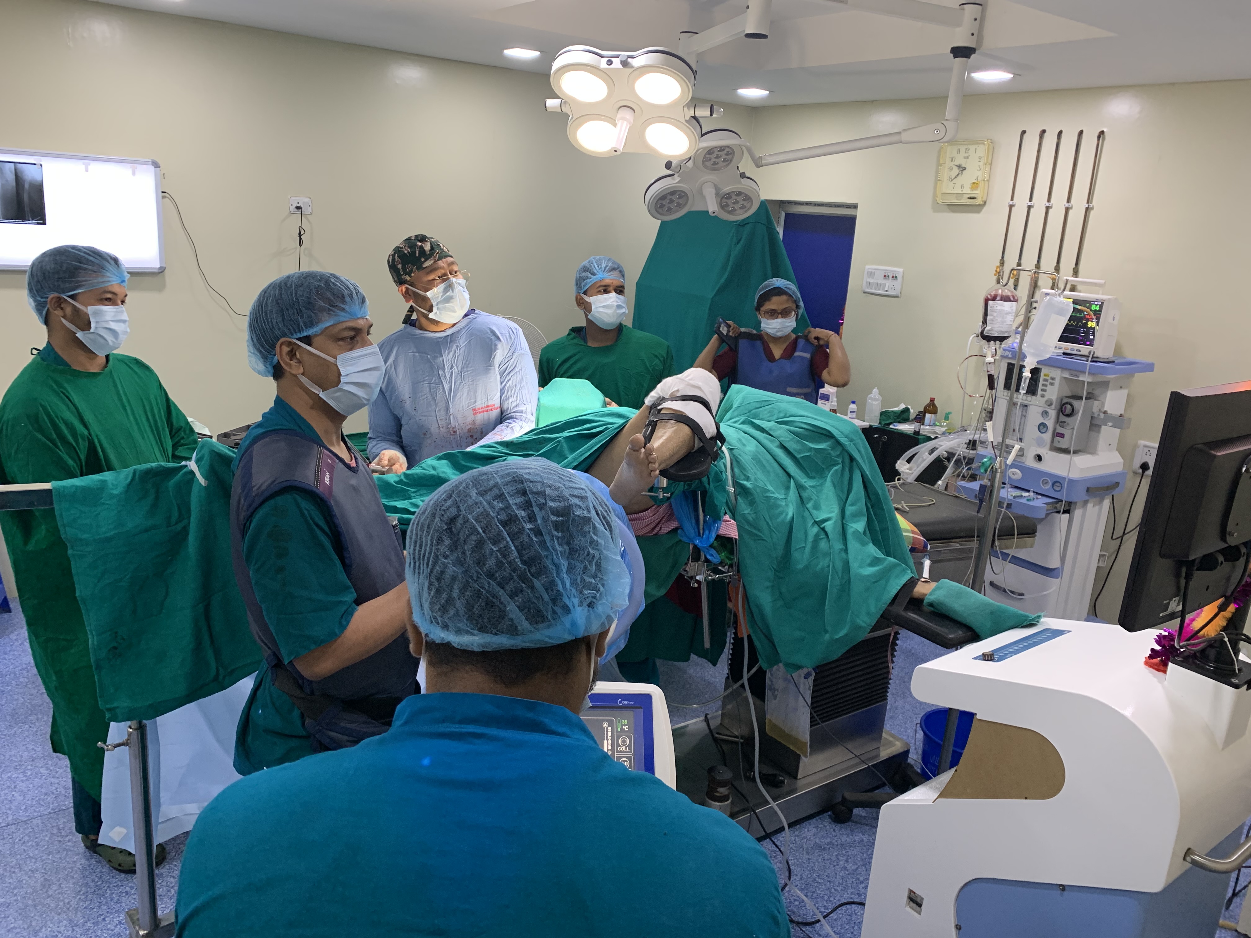 Intertrochanteric femur comminuted fracture treated by Closed Reduction & Internal Fixation with PFNA2 Titanium Interlocking Nail