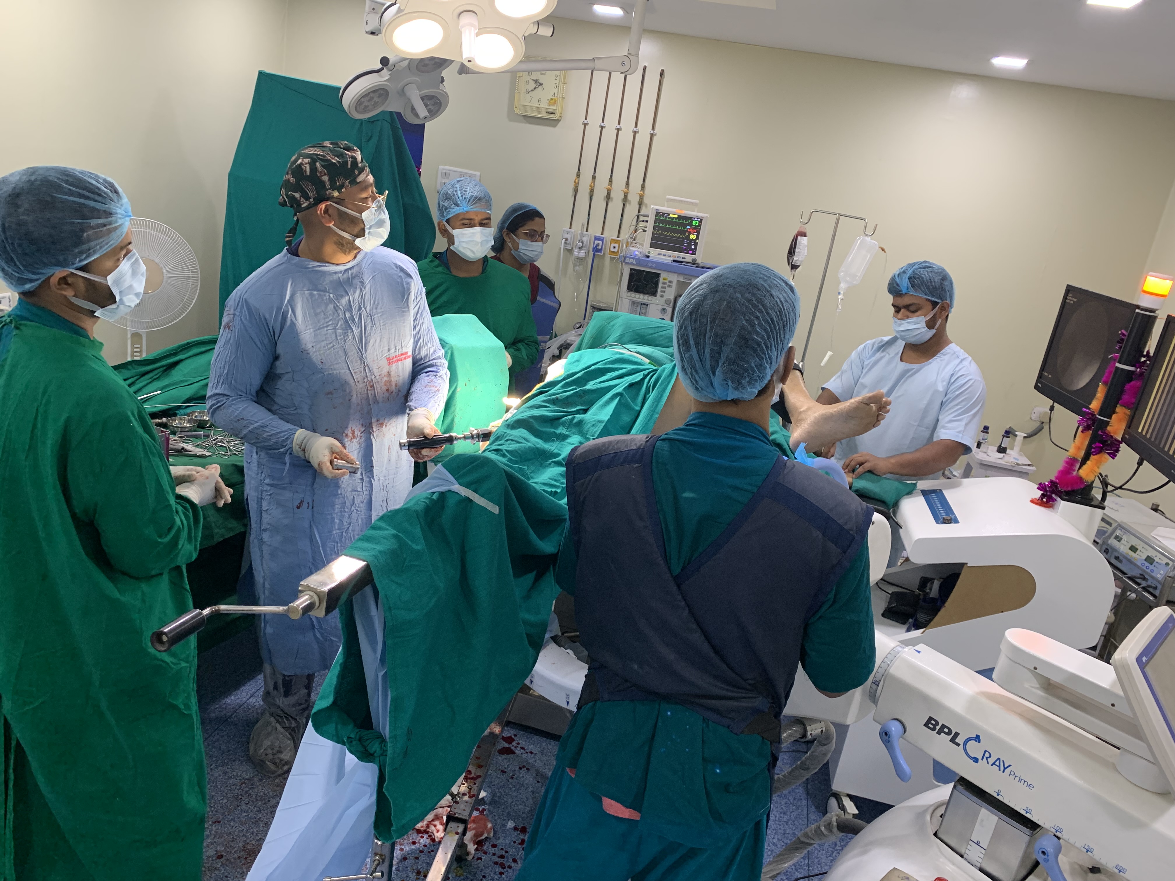 Intertrochanteric femur comminuted fracture treated by Closed Reduction & Internal Fixation with PFNA2 Titanium Interlocking Nail